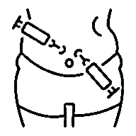 Service Image of Laparoscopy | Genix Fertility Care